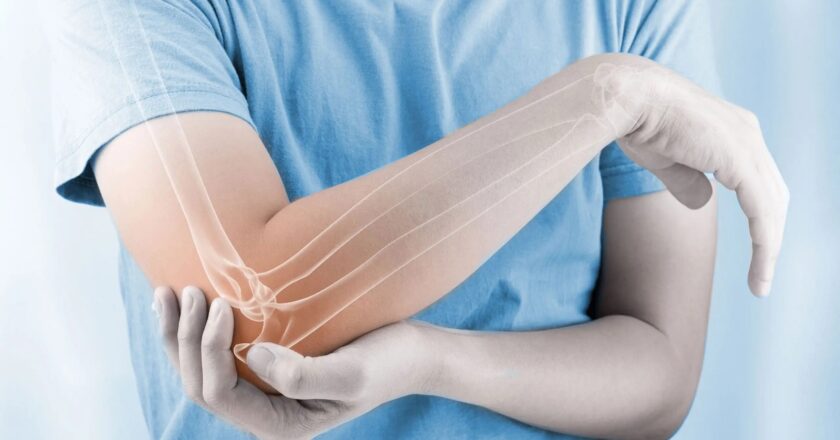 Falta de medicamentos pone en riesgo tratamiento de pacientes con artritis reumatoide