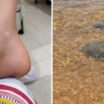 Rayas atacan a veraneantes en Encarnación